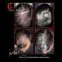 Hair Loss Treatment for Men Mens Hair Loss