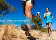 Best Ankle Reconstruction Surgery in Australia by Dr. Gordon Slater