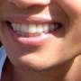 Style Your Smile With Affordable Invisible Braces Cost In Melbourne